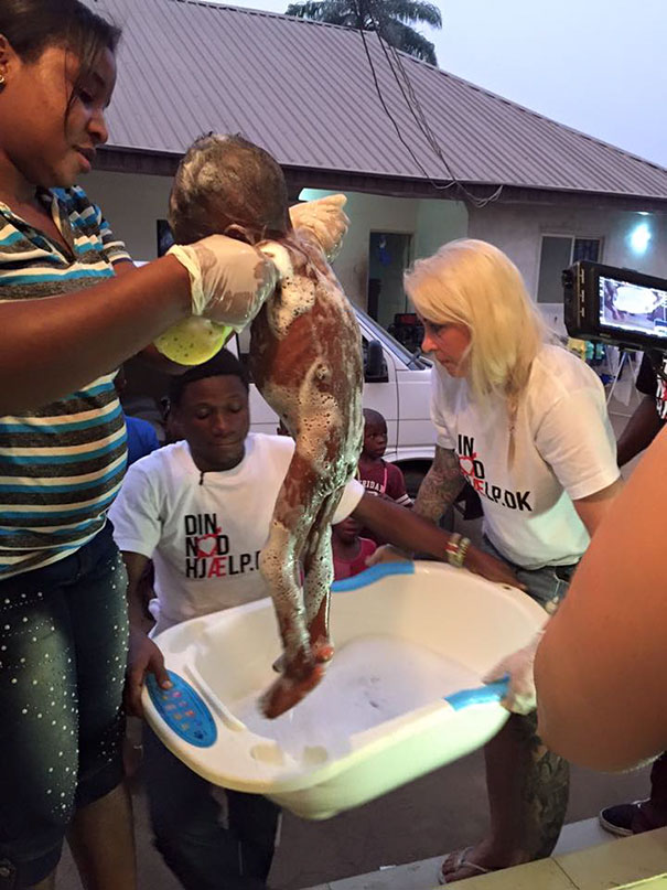 Thanks to Anja, he began to receive medical attention - Heartbreaking Moment When A 2-Year-Old Left To Die Is Given Water In Nigeria Thanks to Anja, he began to receive medical attention - Heartbreaking Moment When A 2-Year-Old Left To Die Is Given Water In Nigeria