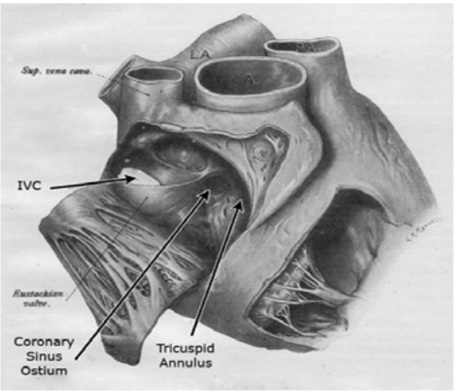 Ostium pharyngeum tubae auditivae. Выводное соустье - ostium maxillare. Заслонка венечного синуса. Ostium ileaсфду.