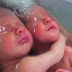 Τα νεογέννητα δίδυμα που νομίζουν ότι είναι ακόμα στην κοιλιά της μητέρας τους (βίντεο).