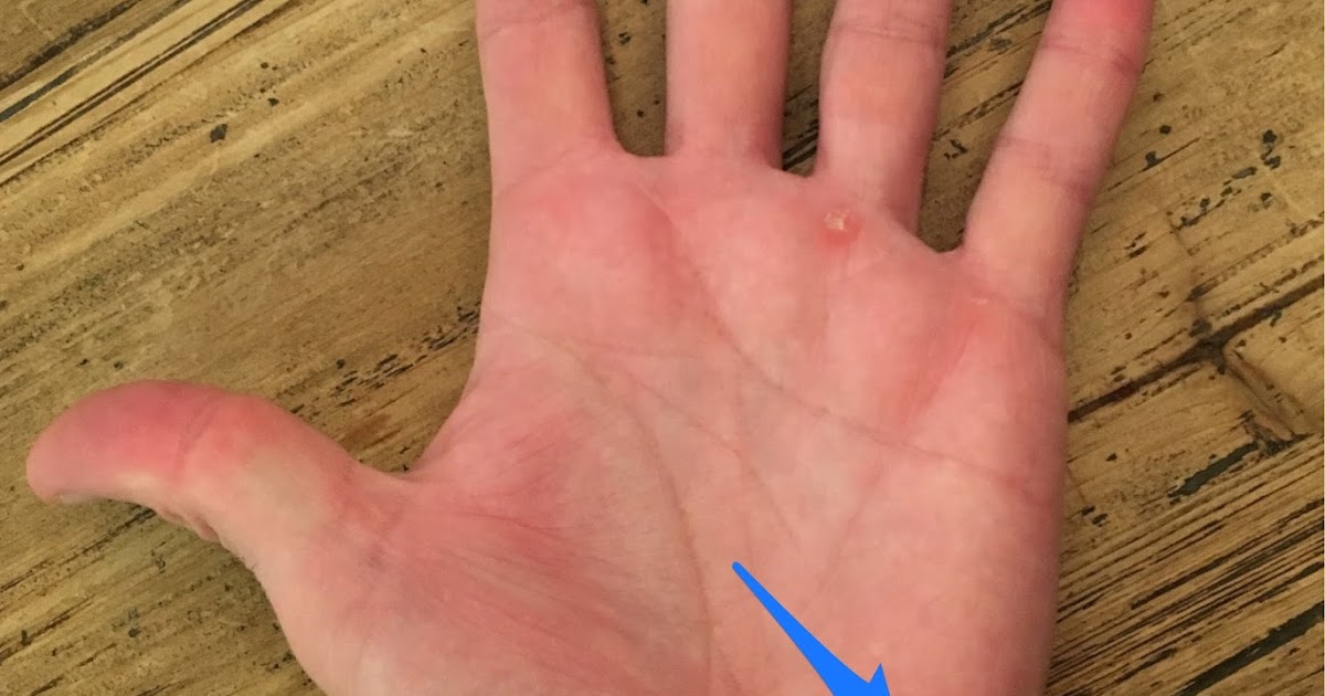 Young Athlete Center Wrist Pain in Baseball