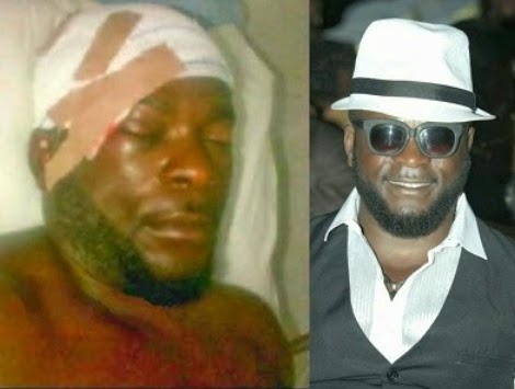 emma ehumadu brain surgery