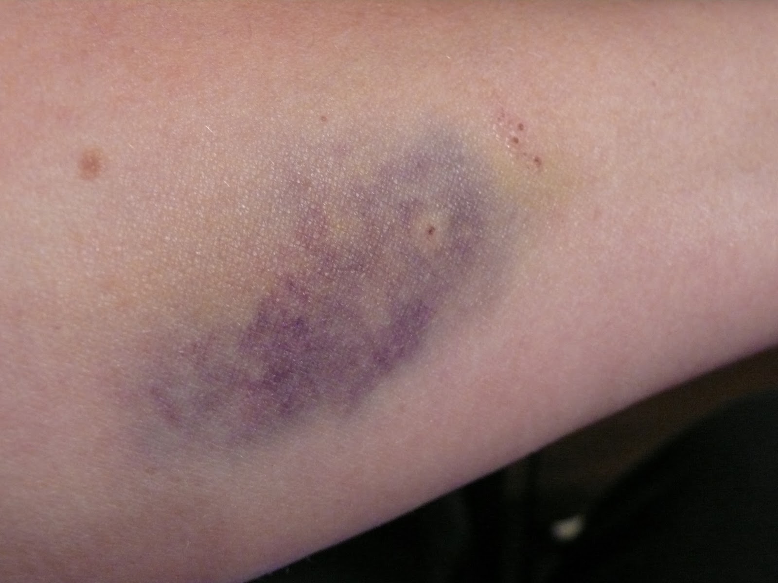 The "Secret" is Gratitude Feeling A Little Blue Bruises