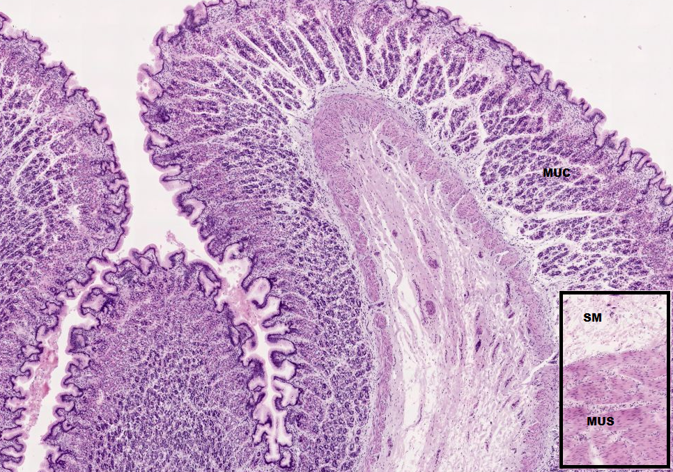 Edema Della Lamina Propria Stomaco