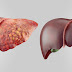 These 6 Foods DETOX Your Liver Fast!