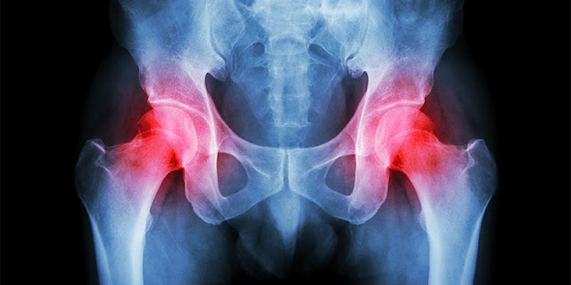 Evaluation of the Patient with Hip Pain | El Paso, TX Chiropractor
