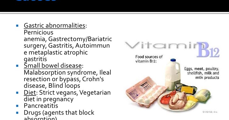 Vitamin B12 Deficiency