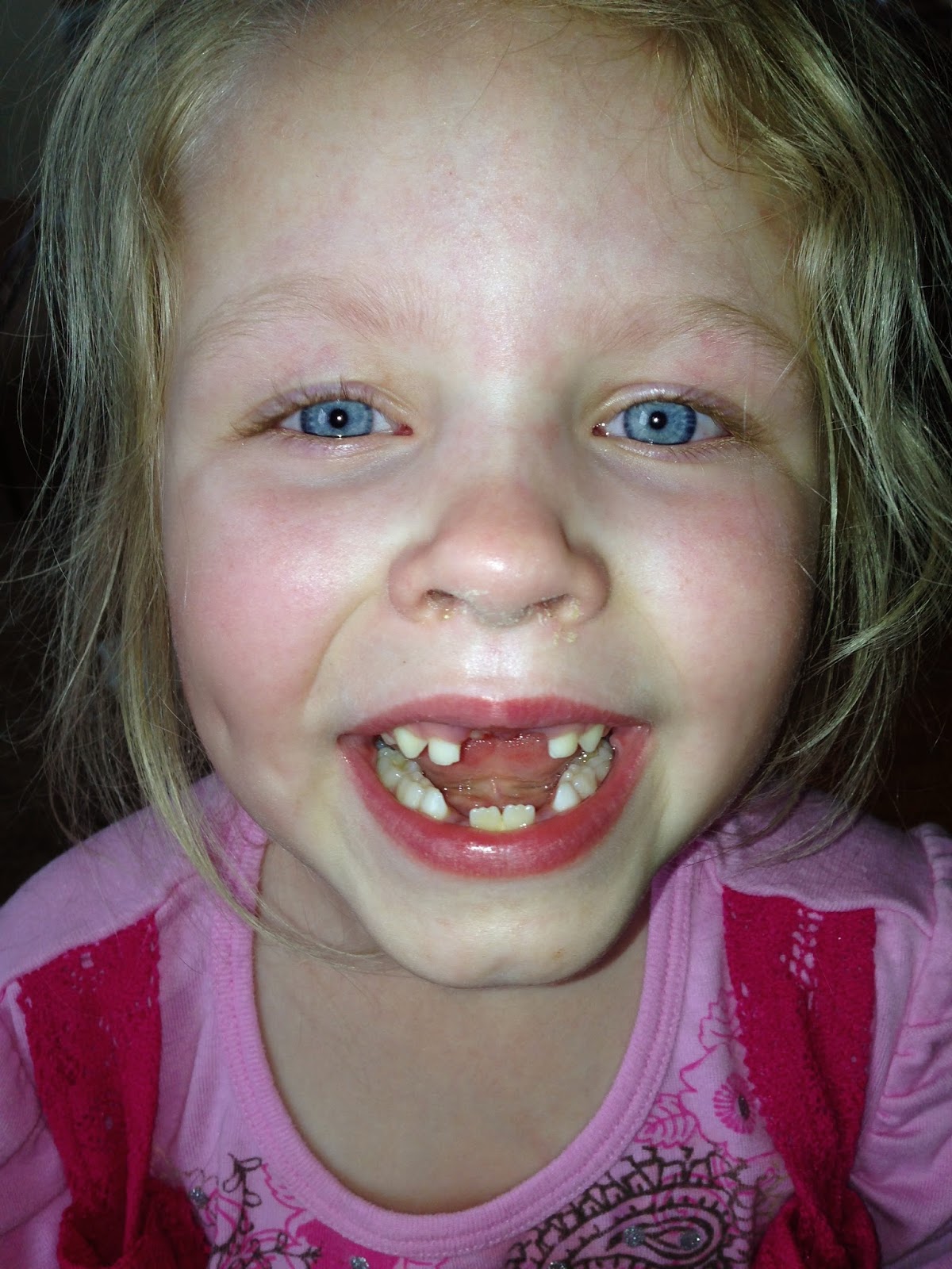 to the Krazy Kingdom Toothless Yet Again + More