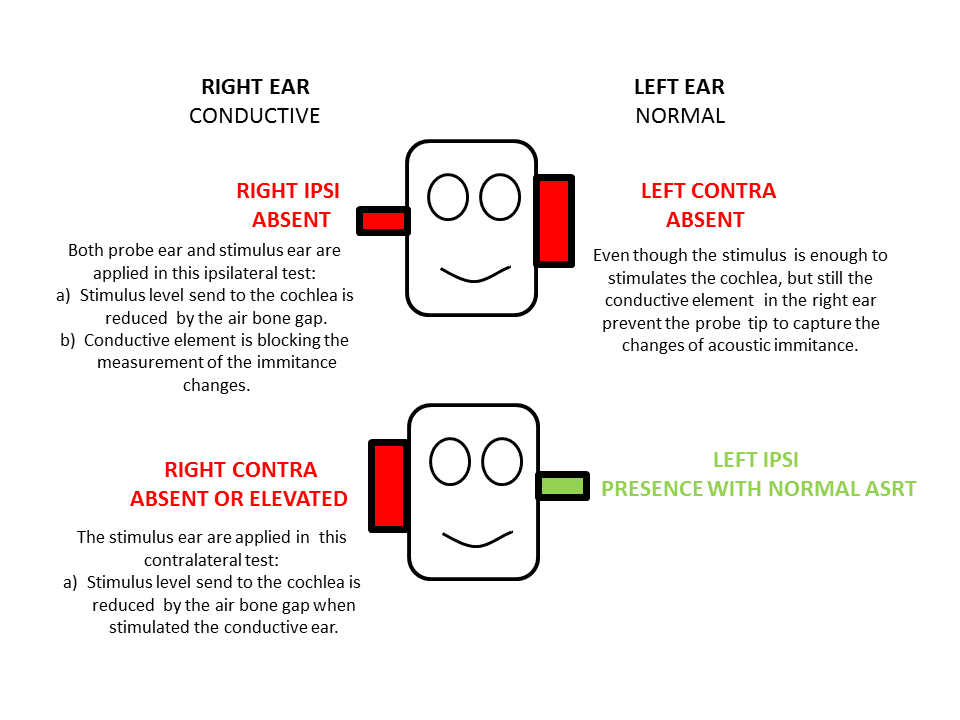 UNDERSTANDING THE PRINCIPLES OF PROBE EAR AND STIMULUS EAR (ACOUSTIC REFLEX) AUDIOLOGIS