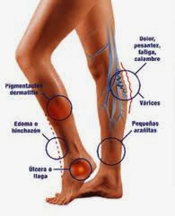 De arterial síntomas las piernas periférica enfermedad de