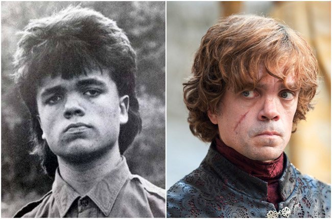 O antes e o depois do sucesso dos atores de Game of Thrones