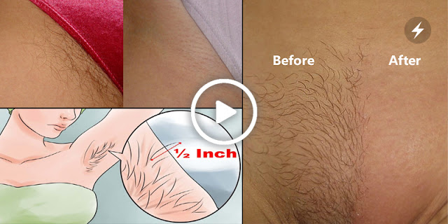 If You Want To Remove Pubic Hair Permanently Then Try This Simple