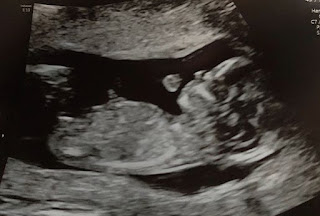 19 haftalık gebelik ultrason görüntüleri