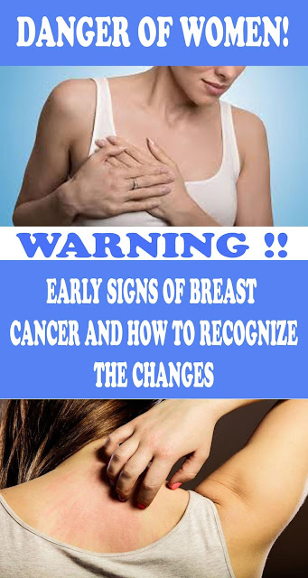 Early Warning Signs of Breast Cancer That Every Woman Shouldn’t Ignore
