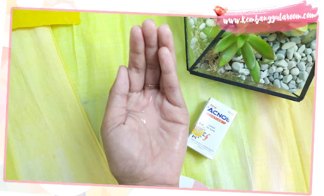 basmi jerawat dengan produk lokal dan harga yang terjangkau basmi jerawat dengan produk lokal dan harga yang terjangkau