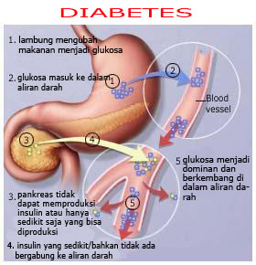 gula darah tinggi apakah diabetes bisa