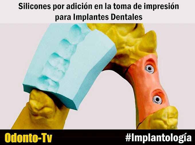 WEBINAR: Silicones por adición en la toma de impresión para Implantes Dentales - Dr. José Gerardo Rivera Crespo