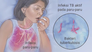 Laporan Pendahuluan Askep Tuberkulosis pdf doc