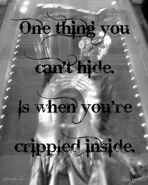 One thing you can't hide. Is when you're crippled inside. - John Lennon