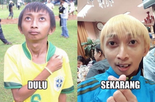 Ingat Si Ceking Ronaldowati Sekarang Ganteng Banget Lihat Nih Pose Kerennya Info Kita