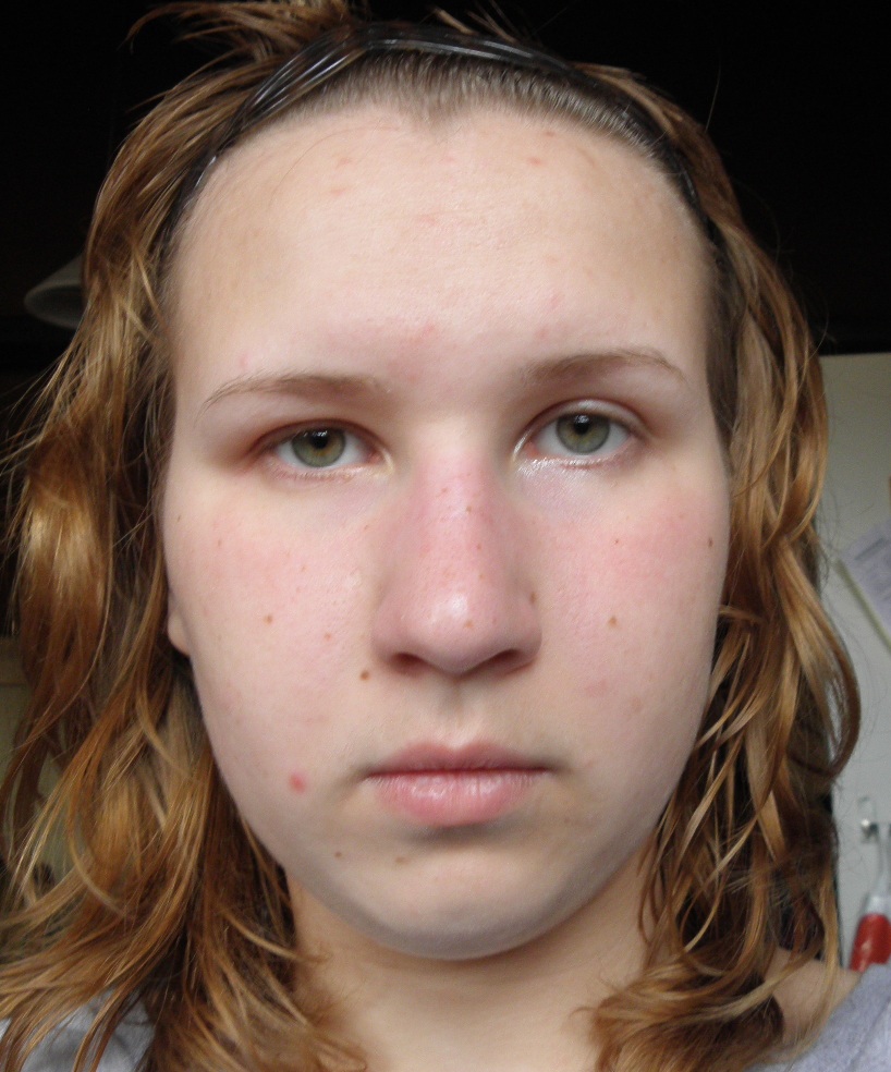 Некрасивая девушка в очках. Девушка с проблемной кожей. Жирная не красивая девушка. Заплаканное лицо девушки. Некрасивое лицо девушки.