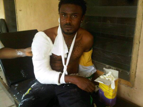 1 Photos of Kano Pillars footballers injured after robbery attack