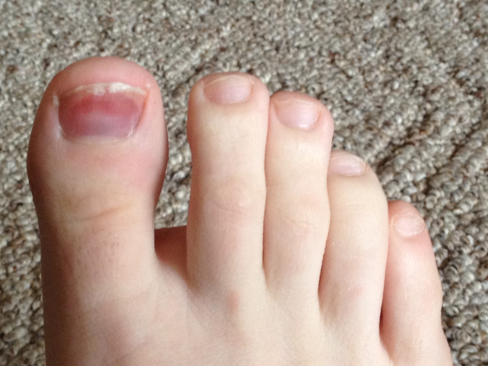 Runs for Cookies Who needs toenails?!