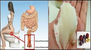 Obat Wasir Fructus Sophorae, Obat Wasir Female Daily, Obat Wasir Facebook, Obat Wasir Farmakologi, Obat Wasir Fargelin, Obat Wasir Faktu Suppositoria, Obat Wasir Fargelin For Piles, Obat Wasir Farmasi, Obat Wasir Faktu Supp, Obat Wasir Factu, Obat Wasir Faktu Ointment, Obat Wasir Fistula, Obat Wasir Kalbe Farma, Harga Obat Wasir Faktu, Obat Wasir Spesial Formula, Obat Wasir Di Kimia Farma,