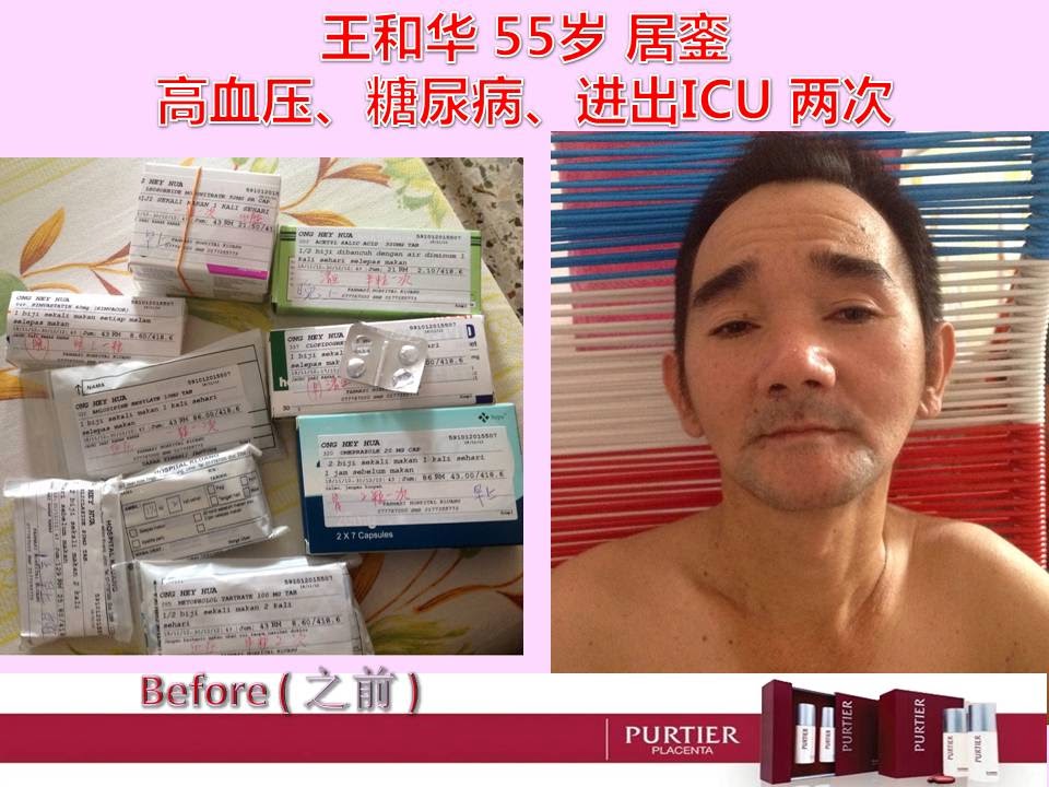 MR WONG (55) KLUANG - HIGH BLOOD PRESSURE (HYPERTENSION), DIABETES, AMITTED TO ICU 2 TIMES