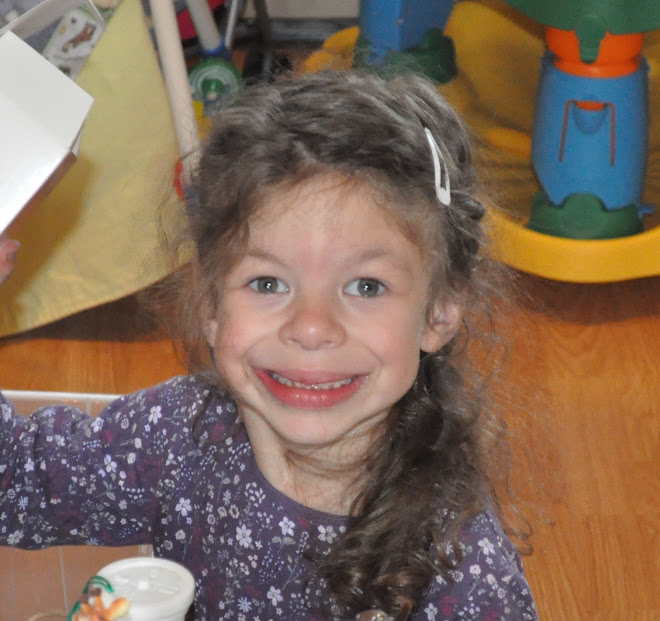 List 102+ Pictures pictures of kids with williams syndrome Sharp List 102+ Pictures pictures of kids with williams syndrome Sharp