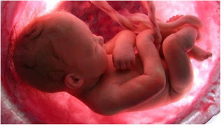gestação sexo do bebê, gravidez, Gui Mazzoni, malformação, Mamãe Gatona, Nasceu uma Mãe, segundo trimestre, Ultrassonografia