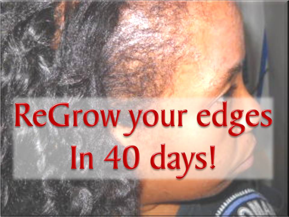 Coilyqueens Grow Your Thinning Edges Back In 40 Days