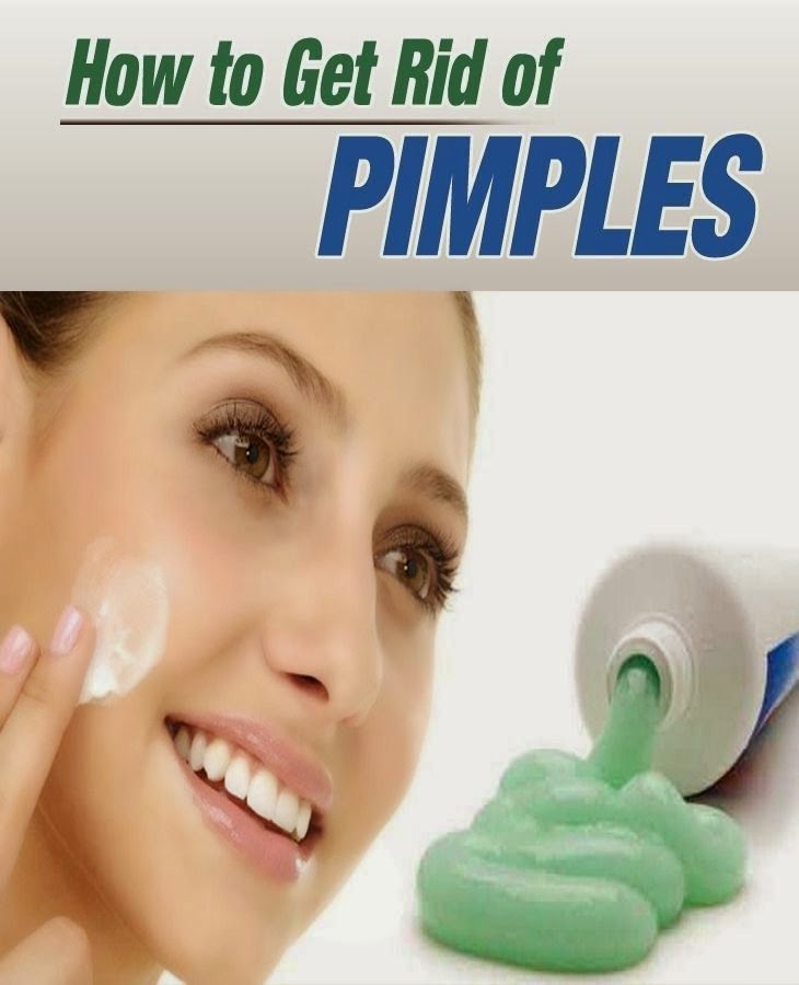 How To Get Rid Of Pimples Fast Simple Ways To Remove Pimples Overnight