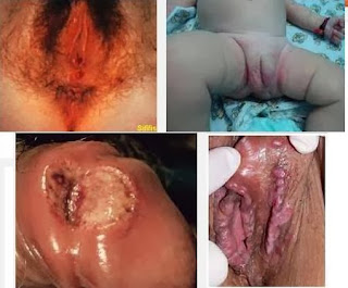 Obat Ampuh Raja Singa Obat Ampuh Raja Singa