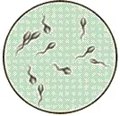 Sperma OligoAsthenozoospermia