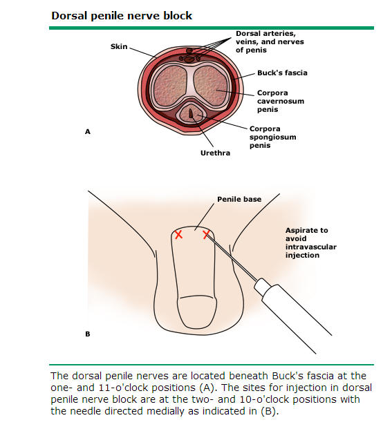 Dorsal Nerve Of Penis 83