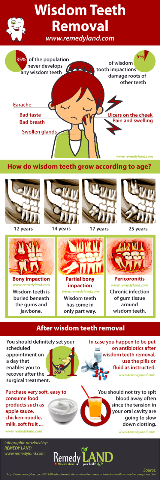 wisdom teeth removal infographic