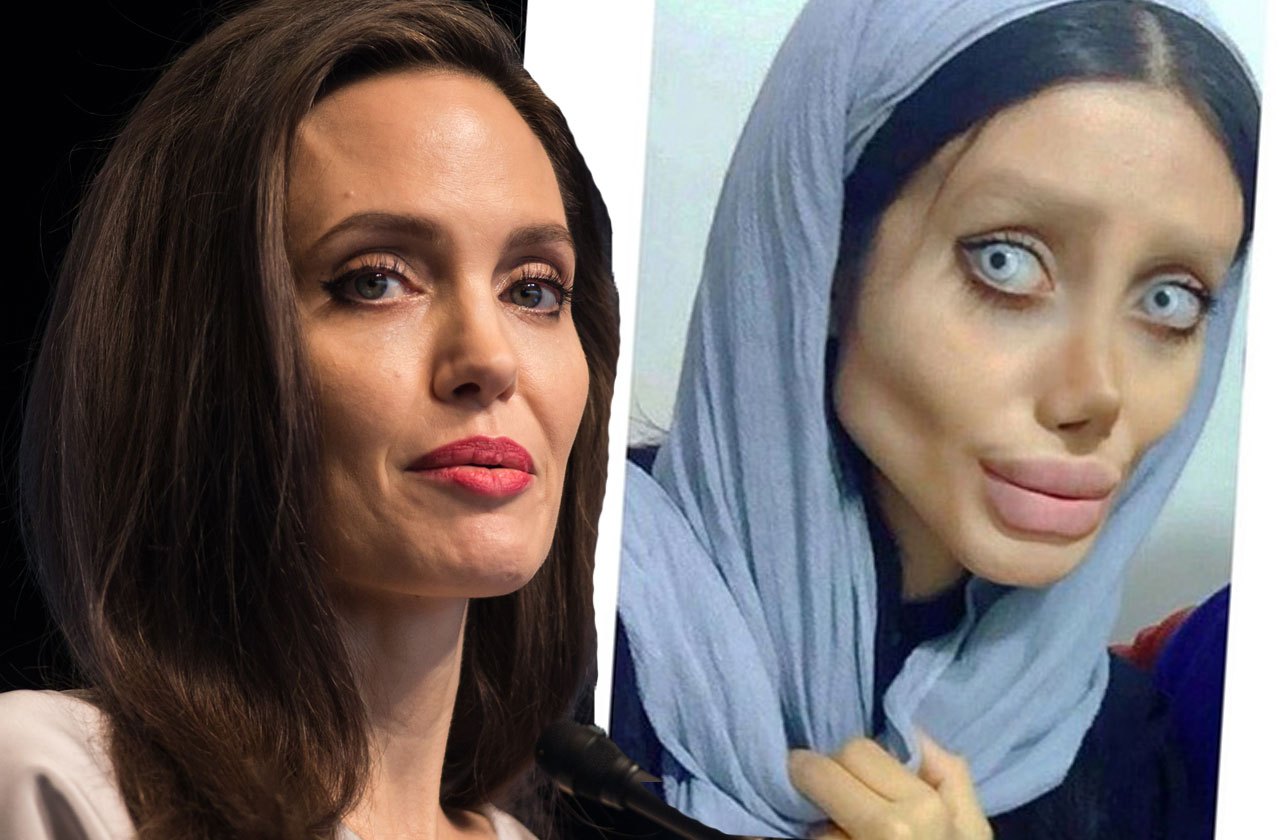 Анджелина Джоли пластические операции