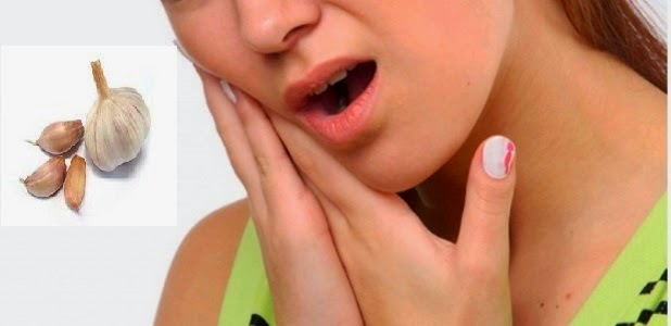 obat sakit gigi paling ampuh