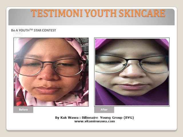 34 Testimoni Youth Skincare Shaklee Terbaru, Youth skincare shaklee, testimoni youth skincare shaklee, Youth Skincare Shaklee : Harga dan Review Pengguna Youth Shaklee, testimoni youth skincare shaklee, testimoni youth skincare shaklee 34 Testimoni Youth Skincare Shaklee Terbaru, Youth skincare shaklee, testimoni youth skincare shaklee, Youth Skincare Shaklee : Harga dan Review Pengguna Youth Shaklee, testimoni youth skincare shaklee, testimoni youth skincare shaklee