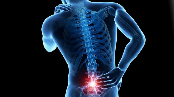 Sering Nyeri Tulang Belakang, Ini Solusinya, Silahkan Di