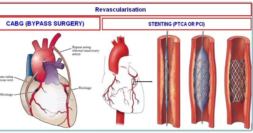 Dr Malleswara Rao MBBS MD DM Cardiology NIMS Dr Malleswara Rao MBBS MD DM Cardiology NIMS