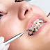 E ngại liệu có nên niềng răng không nhổ răng?