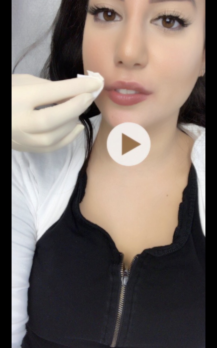 Vanessa S Beauty Blog Ich Habe Mir Die Lippen Aufspritzen Lassen