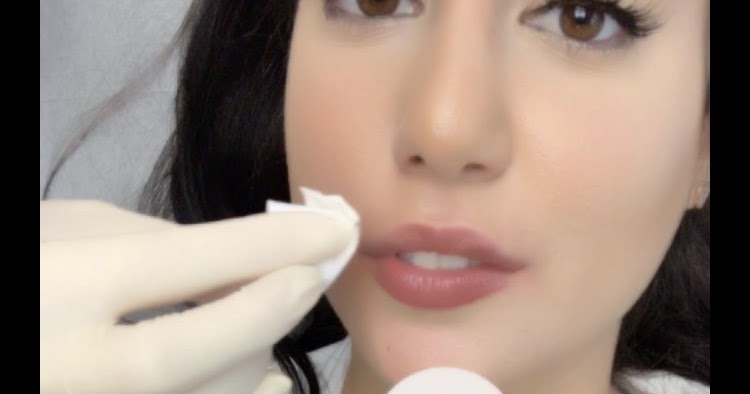 Vanessa S Beauty Blog Ich Habe Mir Die Lippen Aufspritzen Lassen