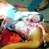 Moradora de rua dá à luz a uma menina em calçada no Centro de João Pessoa