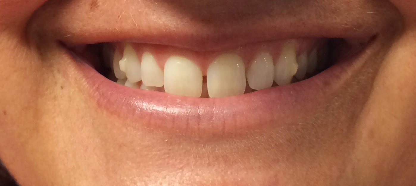 Chip b DDS Clear Correct 'Buttons'