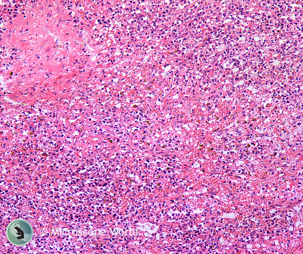 Different Types Of Tissue Under Microscope