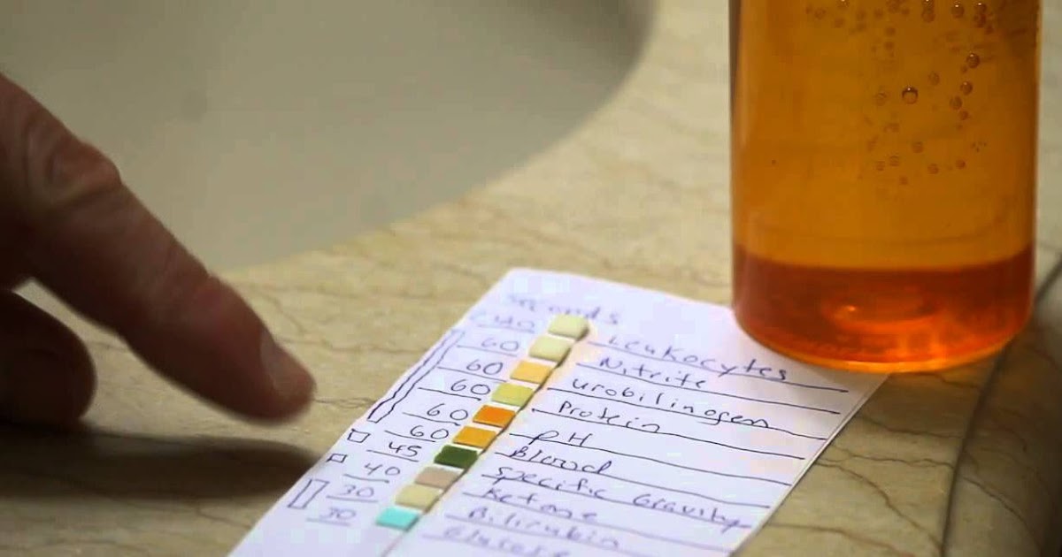 Medical Laboratory and Biomedical Science Urine strip test