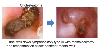 Department Of Otolaryngology Head And Neck Surgery Hokuto Hospital