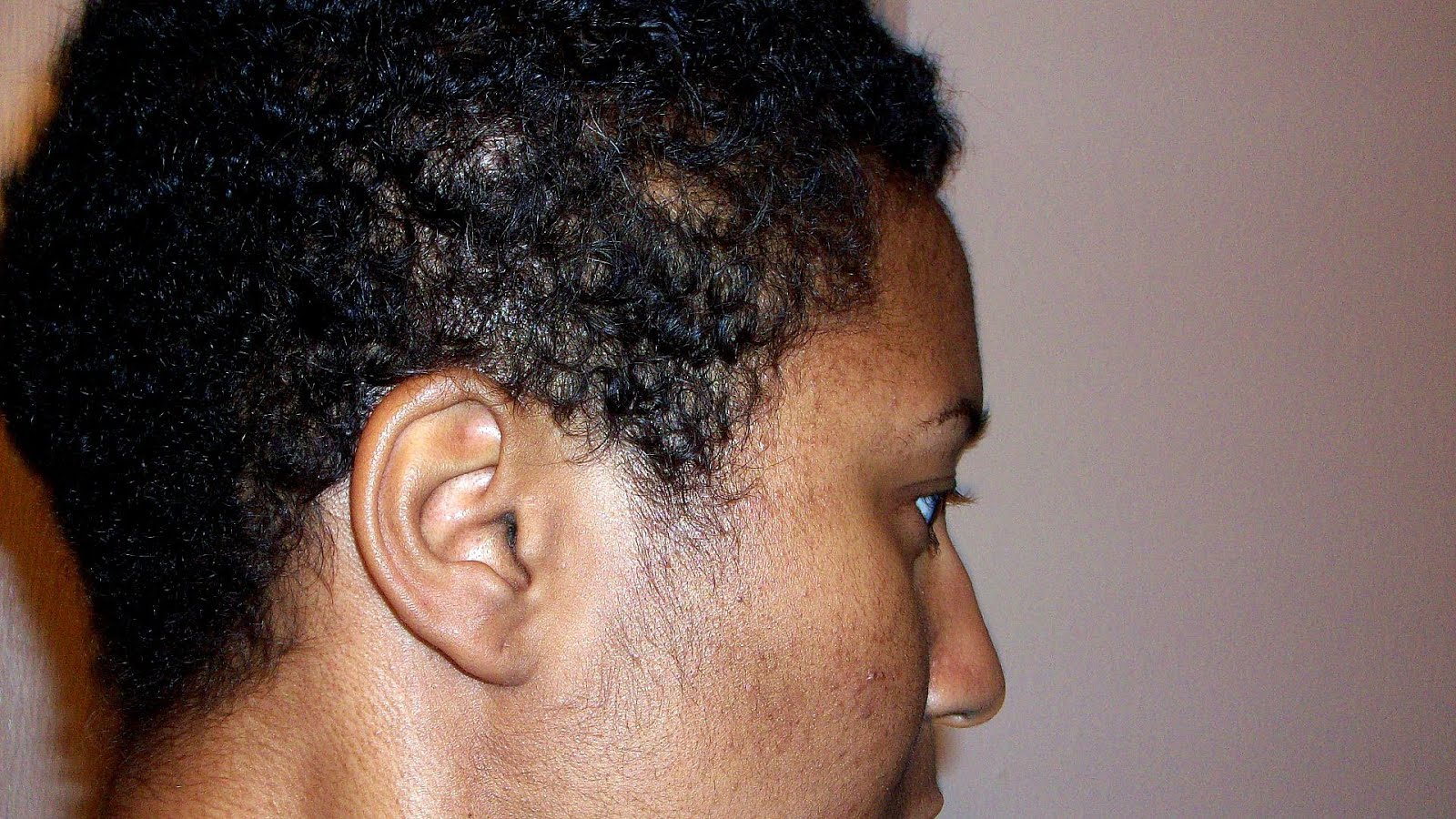 African American Hair After Chemo American Choices